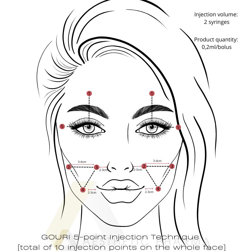 GOURI - 5 point injection technique